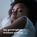 Avarelle Spot Pimple Patches for Face