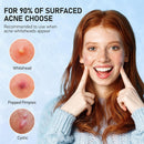 Angtics acne  patches for face