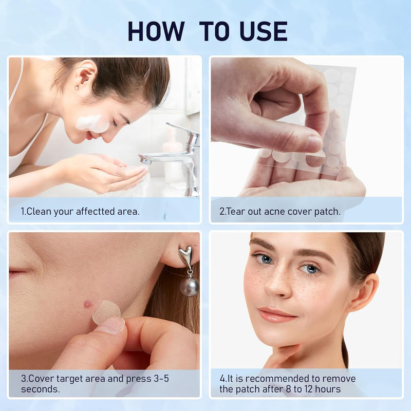 Angtics acne  patches for face